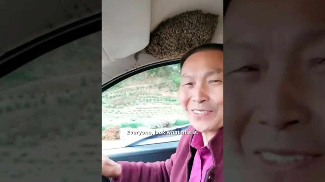 Из-за травмы головы 34-летний китаец до сих пор выглядит как ребенок